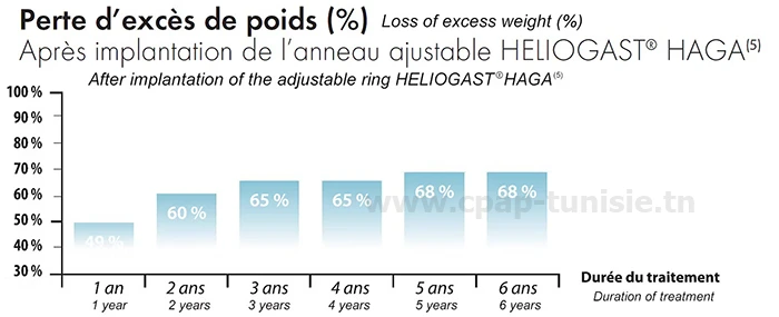 Anneau gastrique HELIOGAST HAGE