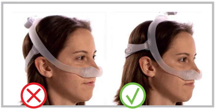 femme comment mettre masque narinaire philips