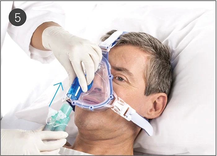 Guide d'utilisation du masque AcuCare